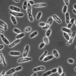 Brettanomyces en la cerveza