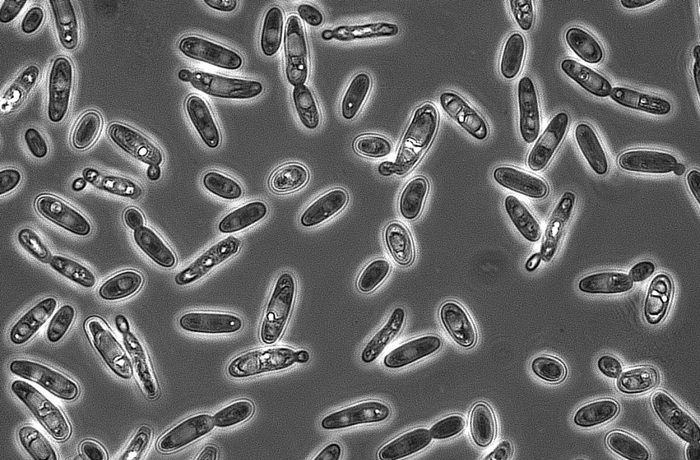 Brettanomyces en la cerveza Brettanomyces en la cerveza