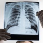 Cerveza y salud pulmonar