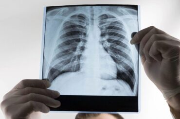 Cerveza y salud pulmonar